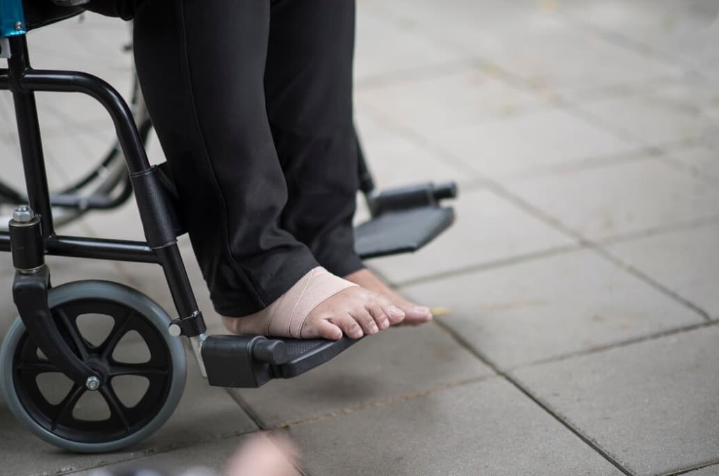 Individual with bandaged foot in wheelchair on the sidewalk