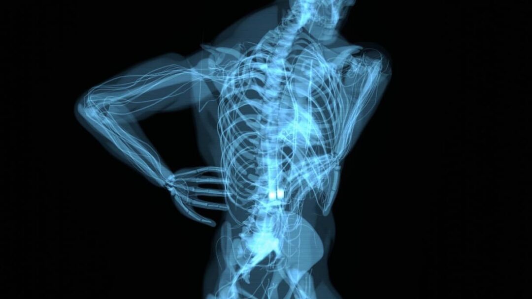 X-ray image of a human torso with a highlighted spine, indicating back pain